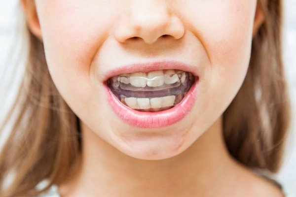 Avez-vous des conseils pour l'entretien des appareils orthodontiques ?